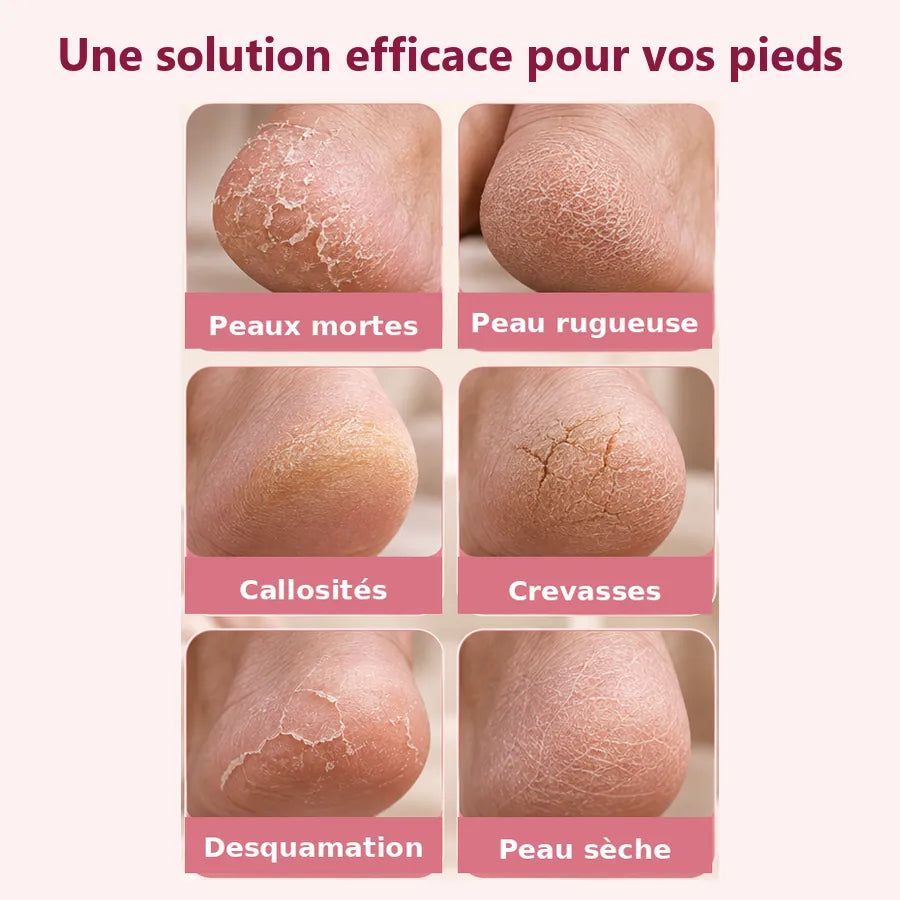 Problèmes de pieds traités